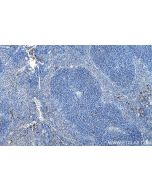 Anti-Mouse Foxp3 (3G3) Proteintech  65089-1-Ig