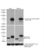 Phospho-NF-κB p65 (Ser468) Recombinant monoclonal antibody Proteintech  82335-1-RR