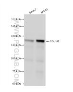 Collagen Type I Recombinant monoclonal antibody Proteintech  83752-5-RR