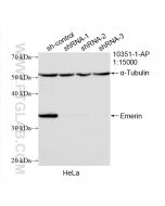 Emerin Polyclonal antibody Proteintech  10351-1-AP