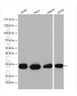 HSP27 Polyclonal antibody Proteintech  18284-1-AP