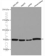 Osteopontin Polyclonal antibody Proteintech  22952-1-AP