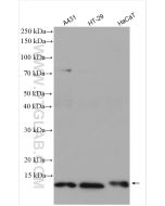 S100A10 Polyclonal antibody Proteintech  11250-1-AP