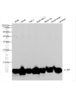 MIF Recombinant monoclonal antibody Proteintech  83199-2-RR