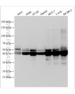 Cytokeratin 19 Polyclonal antibody Proteintech  10712-1-AP