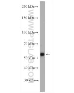 SOX10 Polyclonal antibody Proteintech  10422-1-AP