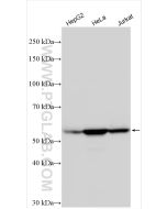 Vimentin Polyclonal antibody Proteintech  10366-1-AP
