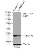 TMEM173/STING Polyclonal antibody Proteintech  19851-1-AP
