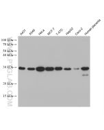 Galectin-3 Monoclonal antibody Proteintech  60207-1-Ig