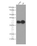 SOX2 Monoclonal antibody Proteintech  66411-1-Ig