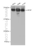 MYOF Recombinant monoclonal antibody Proteintech  82917-2-RR