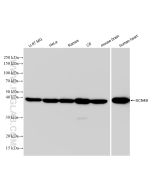 SCN4B Recombinant monoclonal antibody Proteintech  83027-4-RR