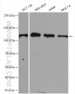 CP110 Polyclonal antibody Proteintech  12780-1-AP