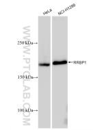 RRBP1 Recombinant monoclonal antibody Proteintech  82890-3-RR