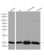 HRAS-Specific Polyclonal antibody Proteintech  18295-1-AP