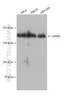 LAMB2 Recombinant monoclonal antibody Proteintech  82946-1-RR