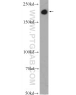 SMMHC Polyclonal antibody Proteintech  21404-1-AP