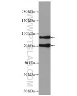 ADAM12 Polyclonal antibody Proteintech  14139-1-AP