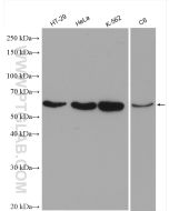 Cyclin B1 Polyclonal antibody Proteintech  28603-1-AP