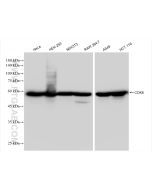 CDK8 Recombinant monoclonal antibody Proteintech  83621-6-RR