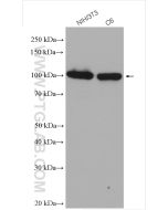 Alpha Actinin Polyclonal antibody Proteintech  11313-2-AP