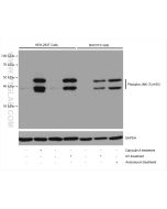 Phospho-JNK (Tyr185) Recombinant monoclonal antibody Proteintech  80024-1-RR