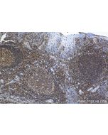 Anti-Human CD45 Rabbit Recombinant Antibody Proteintech  98117-1-RR