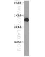 ITPR1-specific Polyclonal antibody Proteintech  19962-1-AP
