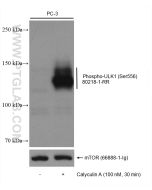 Phospho-ULK1 (Ser556) Recombinant monoclonal antibody Proteintech  80218-1-RR