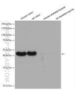 Alpha smooth muscle actin specific Recombinant monoclonal antibody Proteintech  80008-1-RR