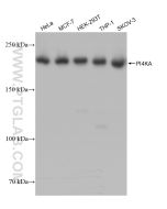 PI4KA Recombinant monoclonal antibody Proteintech  82938-1-RR