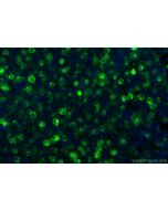 Anti-Human CD83 (HB15e) Mouse IgG2a Recombinant Antibody Proteintech  65581-1-MR