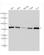 STAT1 Polyclonal antibody Proteintech  10144-2-AP