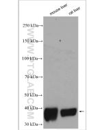 GSNOR,ADH5 Polyclonal antibody Proteintech  11051-1-AP