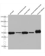 GLUT4 Monoclonal antibody Proteintech  66846-1-Ig