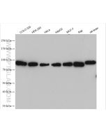 IMMT Polyclonal antibody Proteintech  10179-1-AP