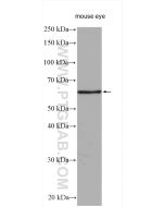 TGFBI/BIGH3 Polyclonal antibody Proteintech  10188-1-AP