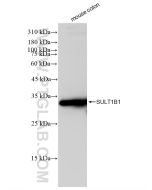 SULT1B1 Recombinant monoclonal antibody Proteintech  83228-1-RR