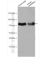 P2RX7 Polyclonal antibody Proteintech  28207-1-AP