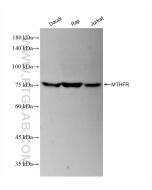 MTHFR Recombinant monoclonal antibody Proteintech  83372-7-RR