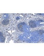 Ki-67 Polyclonal antibody Proteintech  28074-1-AP