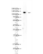PI3 Kinase p110 Beta Polyclonal antibody Proteintech  20584-1-AP