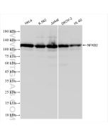 NFKB2,p100 Recombinant monoclonal antibody Proteintech  84022-5-RR