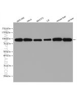 Beta Catenin Polyclonal antibody Proteintech  17565-1-AP