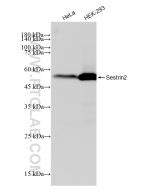 Sestrin 2 Recombinant monoclonal antibody Proteintech  83202-3-RR