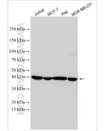 BCAT2 Polyclonal antibody Proteintech  16417-1-AP