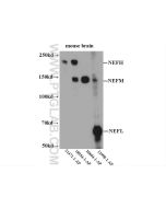NF-L Polyclonal antibody Proteintech  12998-1-AP