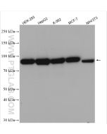 Calnexin Polyclonal antibody Proteintech  10427-2-AP
