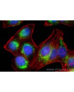 Anti-Human CD107a / LAMP1 (H4A3) Mouse IgG2a Recombinant Antibody Proteintech  65596-1-MR