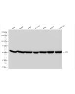 ATIC Recombinant monoclonal antibody Proteintech  84798-5-RR